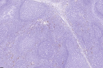 Mast cell tryptase